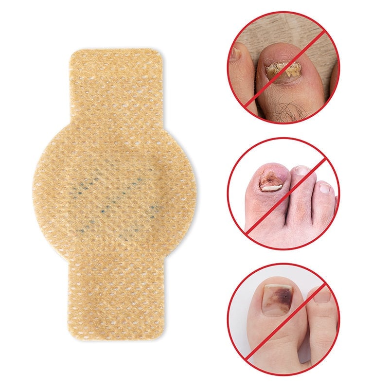 FungalPatch - Antibakteriell Pilzbefall Flicken Und Nagelpflege Packung