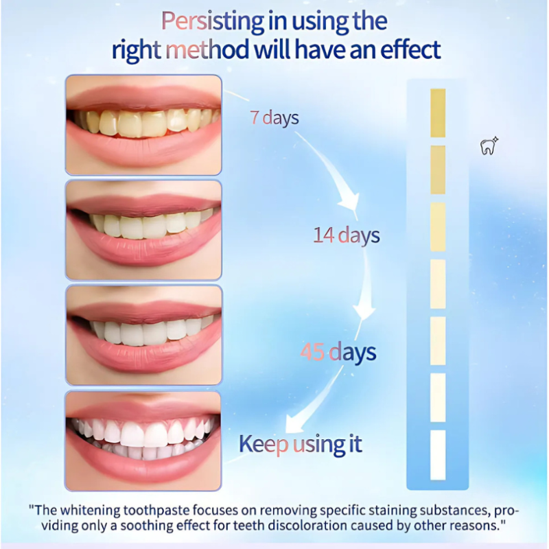 WhiteningToothpaste 1+1 GRATIS: Niacinamid Aufhellende Und Fleckenentfernende Zahnpasta