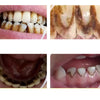DentalCare –Einfaches 360° Zahnpflege-Werkzeugset Zuhause